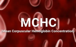 Mean Corpuscular Hemoglobin Concentration (MCHC) and its Clinical Significance