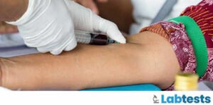 What Complications Can You Face During Blood Collection & How to perform Venipuncture ?
