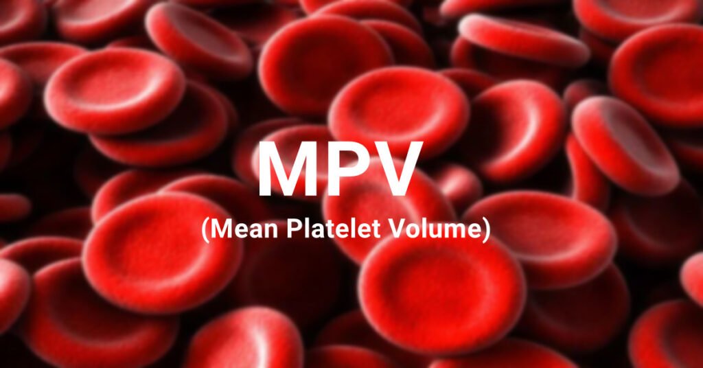 Mean platelet volume (MPV) blood test- High and Low levels ...