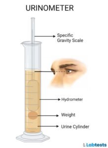 Urine Specific Gravity Test : Procedure, (Normal Range, High, Low) Clinical Significance