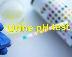 Urine pH test : Procedure, Causes (Normal, Low, High) and Clinical Significance