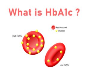 HbA1c test : Introduction, Normal Values, and Clinical Interpretation