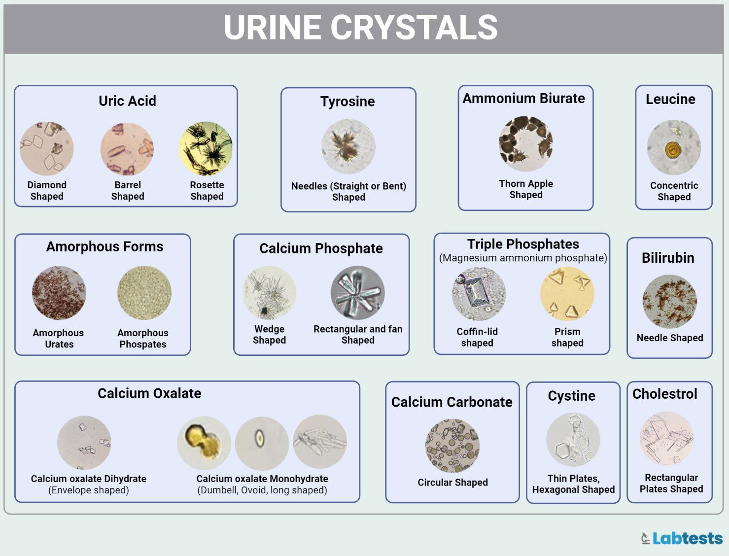 Urine crystals list images pictures