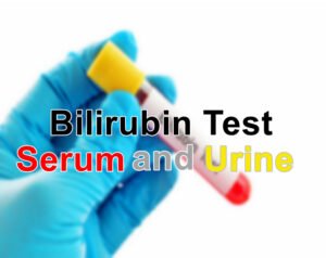 Blood (Serum) Bilirubin and Urine Bilirubin Tests : Normal range and Result Interpretation